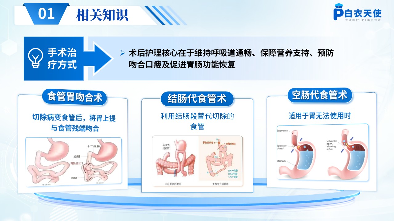 274期-护理查房-食管癌患者术后护理查房第4页预览
