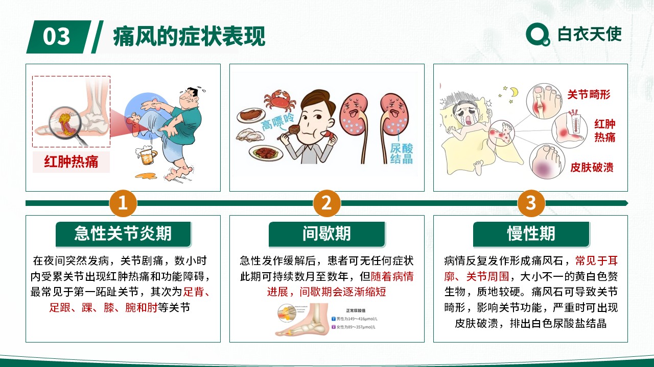 17-警惕痛风健康宣教第5页预览