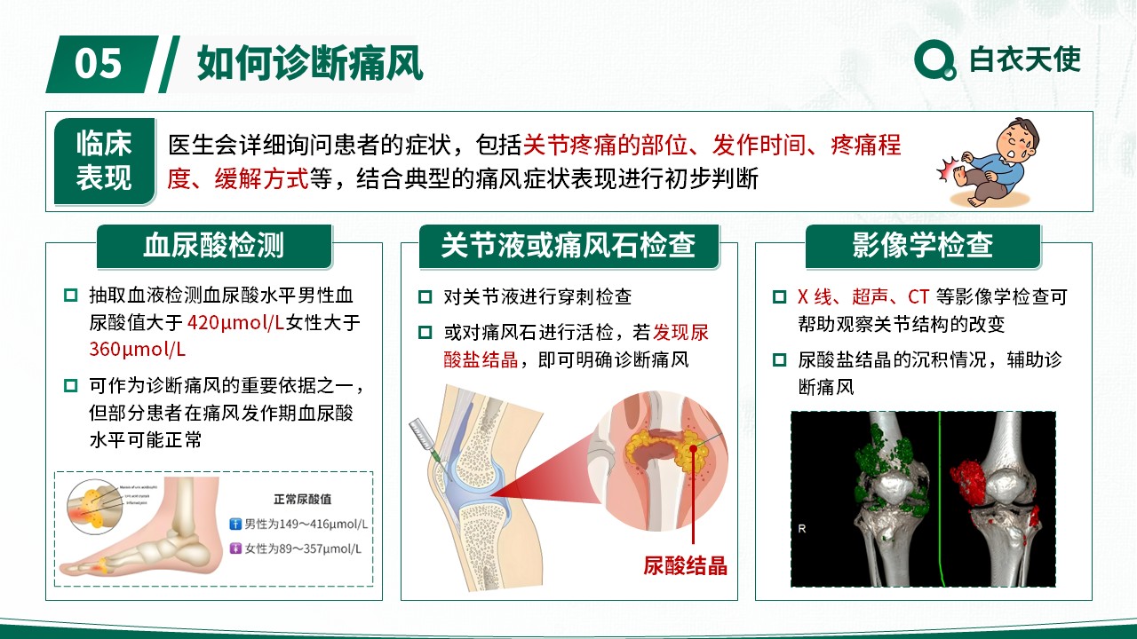 17-警惕痛风健康宣教第7页预览