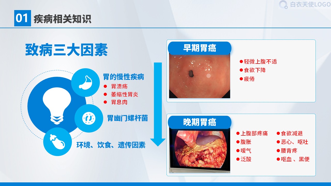 01-胃癌术后护理查房第5页预览