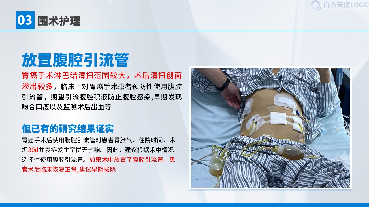 01-胃癌术后护理查房第15页预览