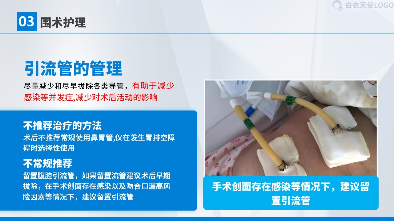 01-胃癌术后护理查房第18页预览