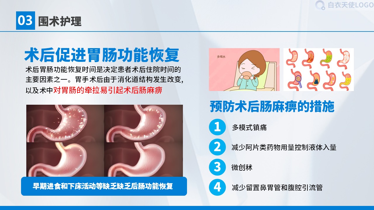 01-胃癌术后护理查房第20页预览