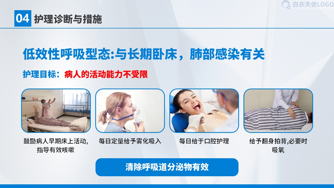 01-胃癌术后护理查房第28页预览