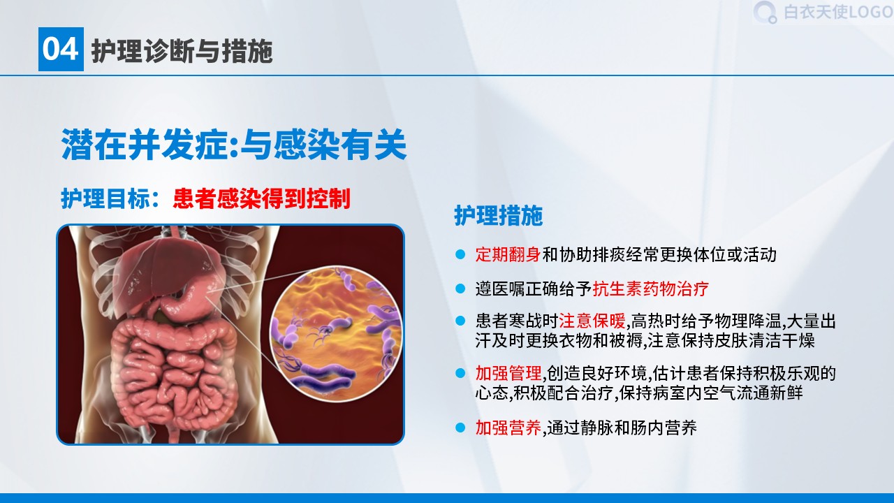 01-胃癌术后护理查房第30页预览