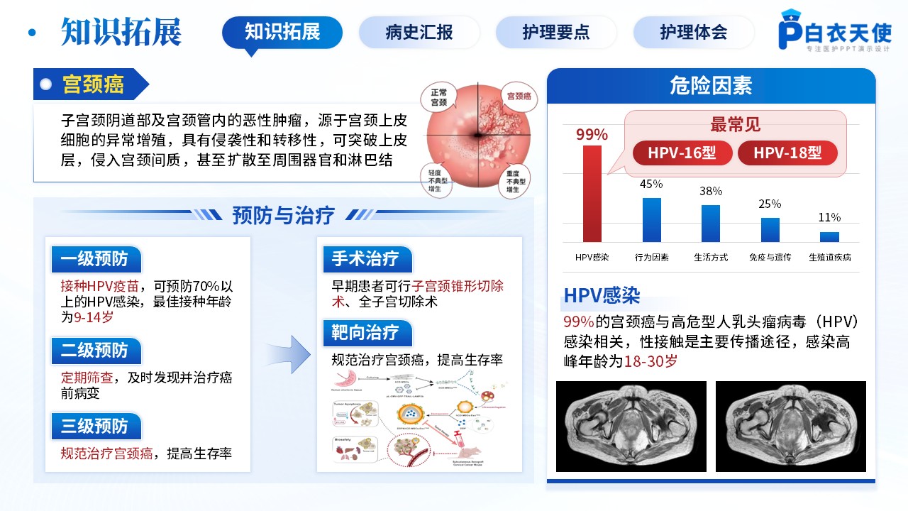 208期-病例汇报-宫颈癌根治术后的护理干预研究第3页预览