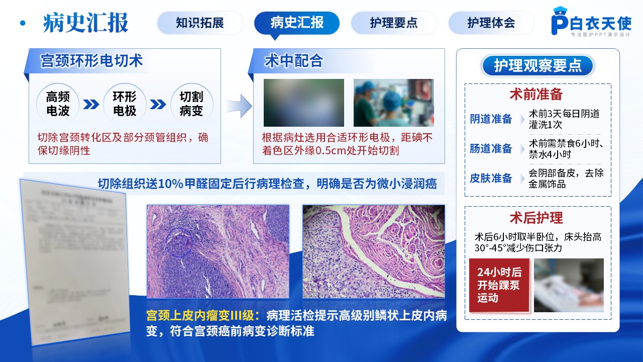 208期-病例汇报-宫颈癌根治术后的护理干预研究第8页预览