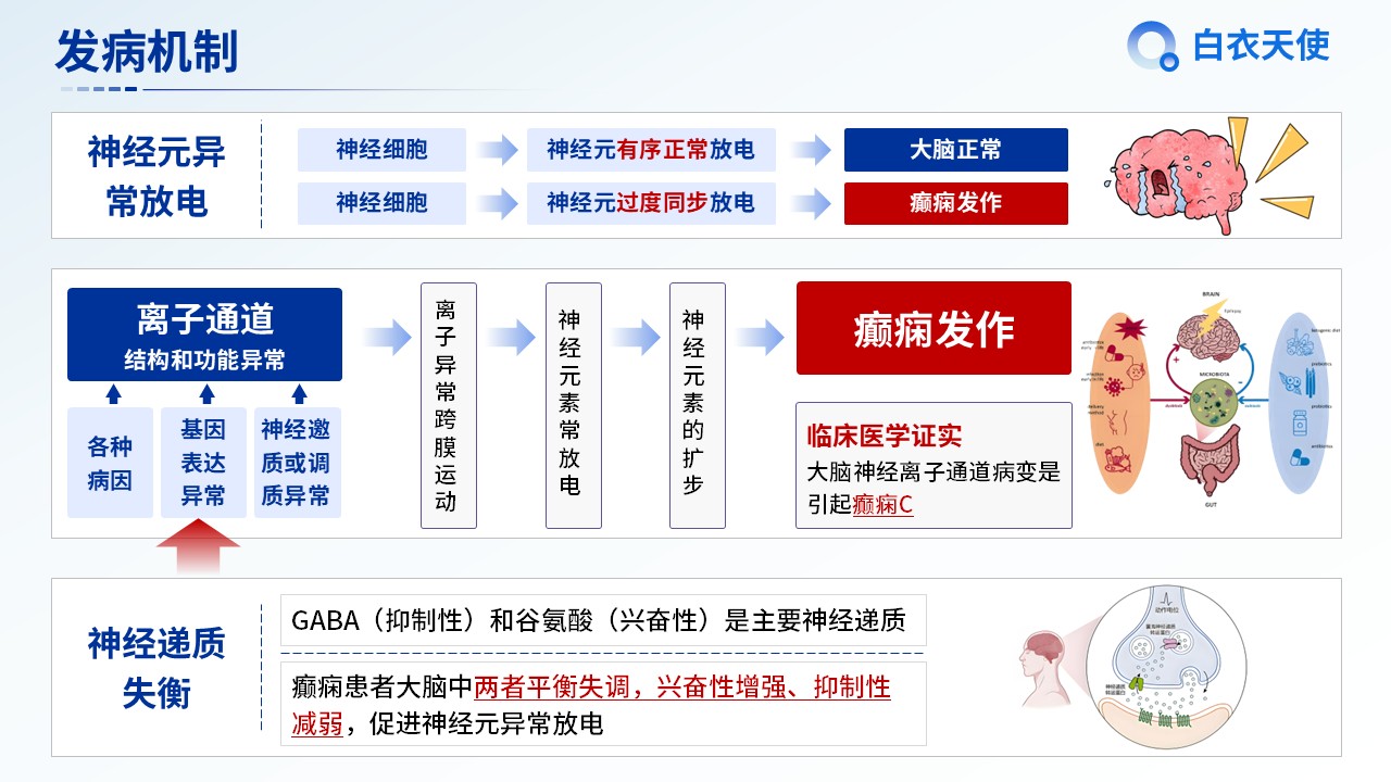 04-癫痫健康宣教第5页预览