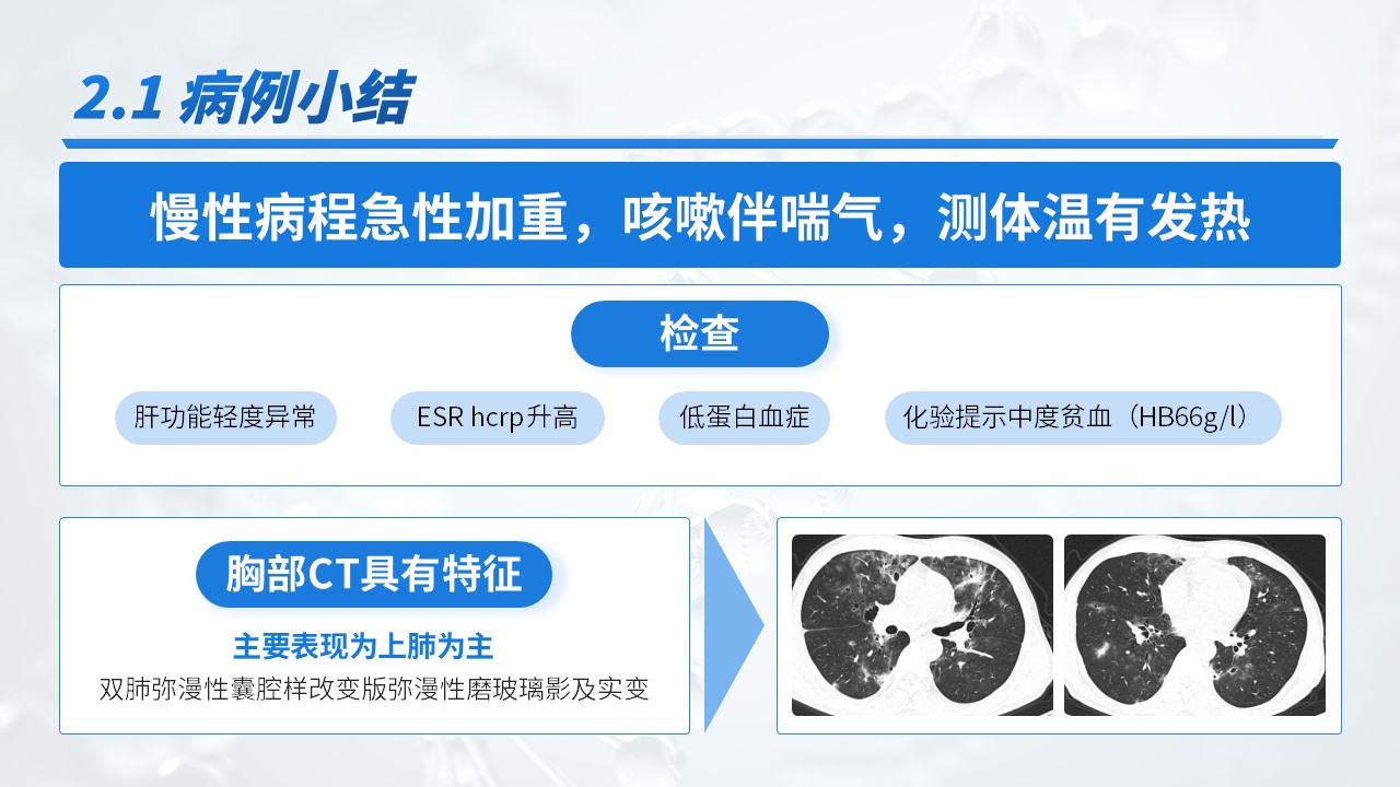 23-重症肺炎耶氏孢子菌肺炎病例介绍第9页预览