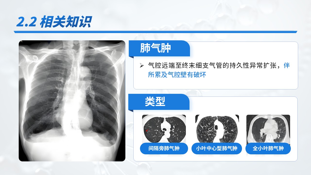 23-重症肺炎耶氏孢子菌肺炎病例介绍第10页预览