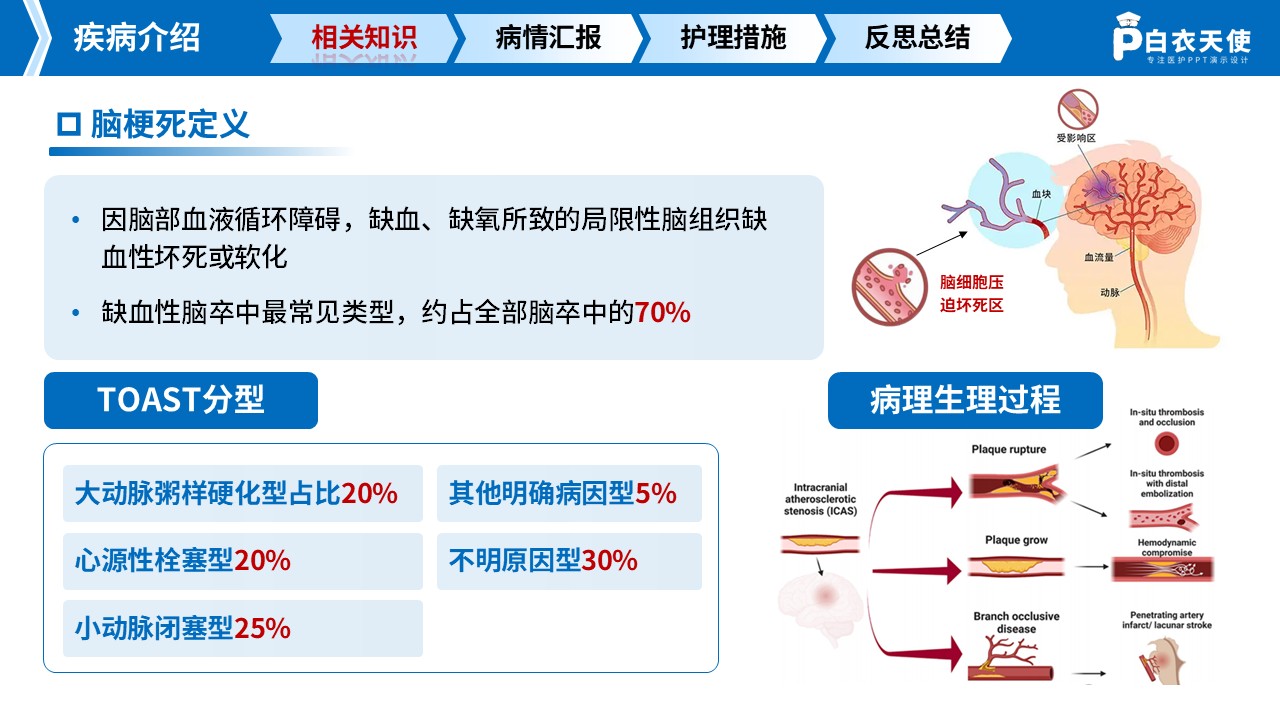 282期-护理查房-一例中风脑梗死急性期患者循证护理查房第3页预览