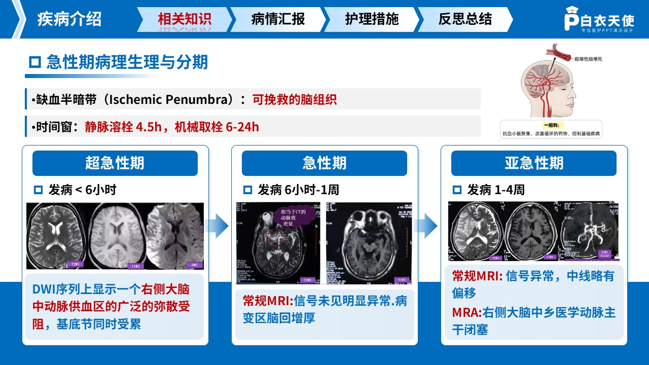 282期-护理查房-一例中风脑梗死急性期患者循证护理查房第4页预览