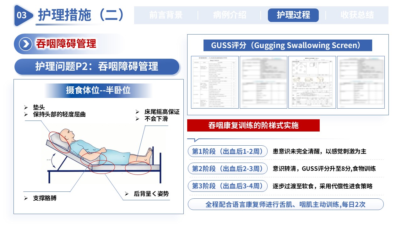 419期-护理个案-一例急性脑梗死静脉溶栓后出血转化合并吞咽障碍的护理个案第13页预览