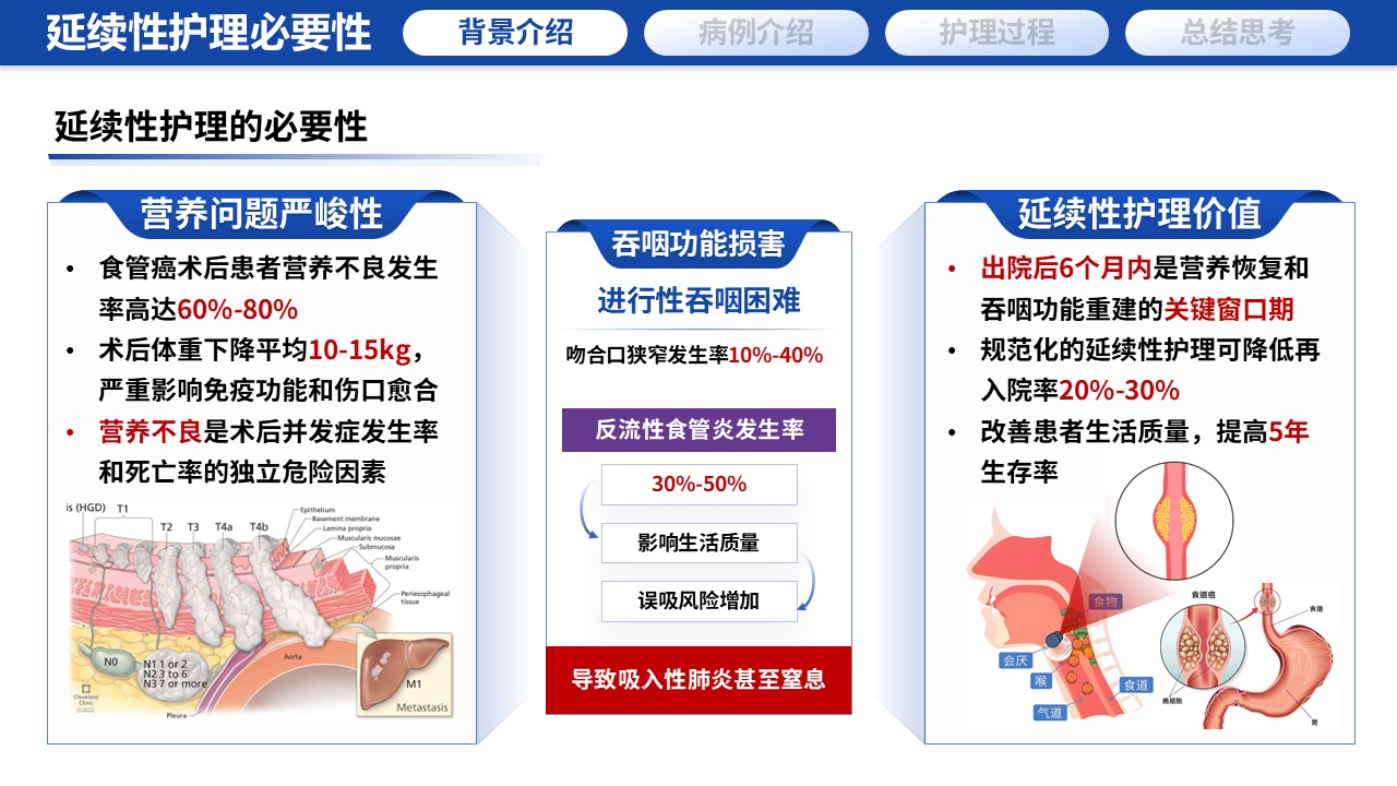 389期-护理个案-一例食管癌术后营养管理与吞咽功能康复的延续性护理个案第5页预览