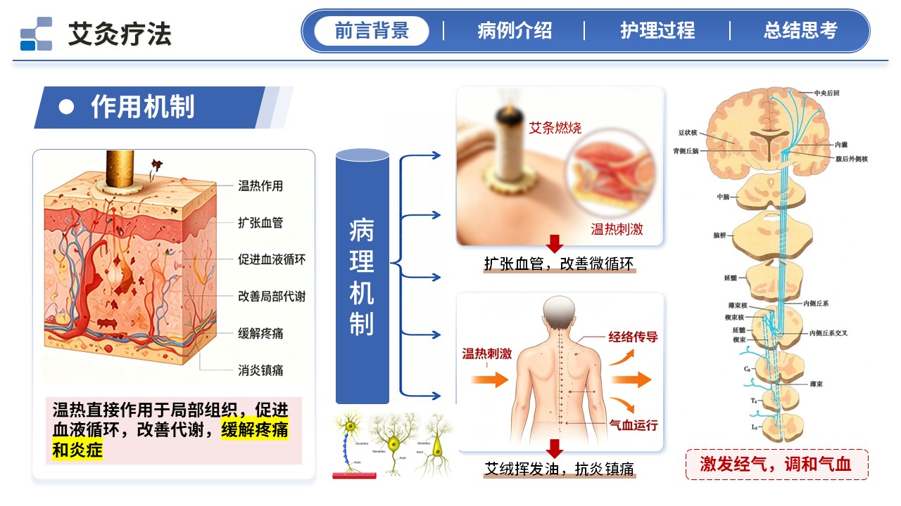 406期-护理个案 - 一例艾灸温经散寒治疗寒湿型腰痛患者的中医护理个案第4页预览