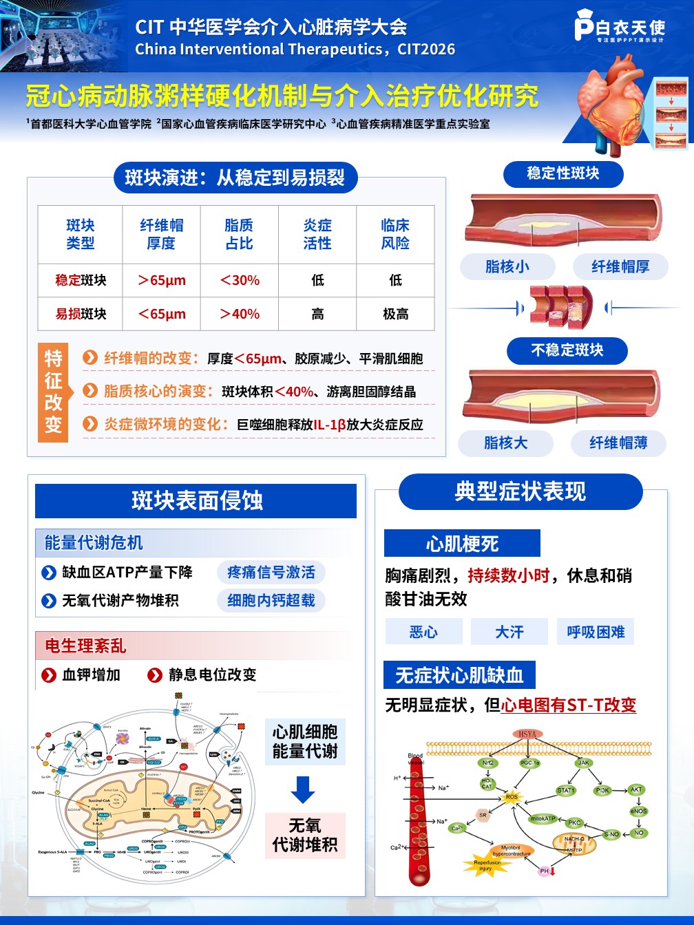 1-医疗展板-冠心病动脉粥样硬化机制与介入治疗优化研究第2页预览