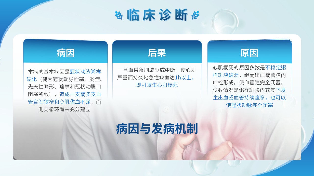 80-急性心肌梗塞护理查房第14页预览