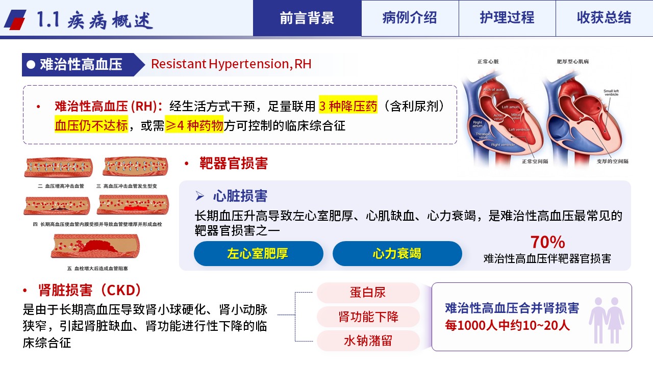 497期-疑难病例-一例难治性高血压合并靶器官损害疑难病例第3页预览