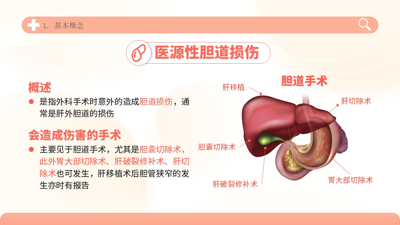 04-胆道损伤护理方案第5页预览