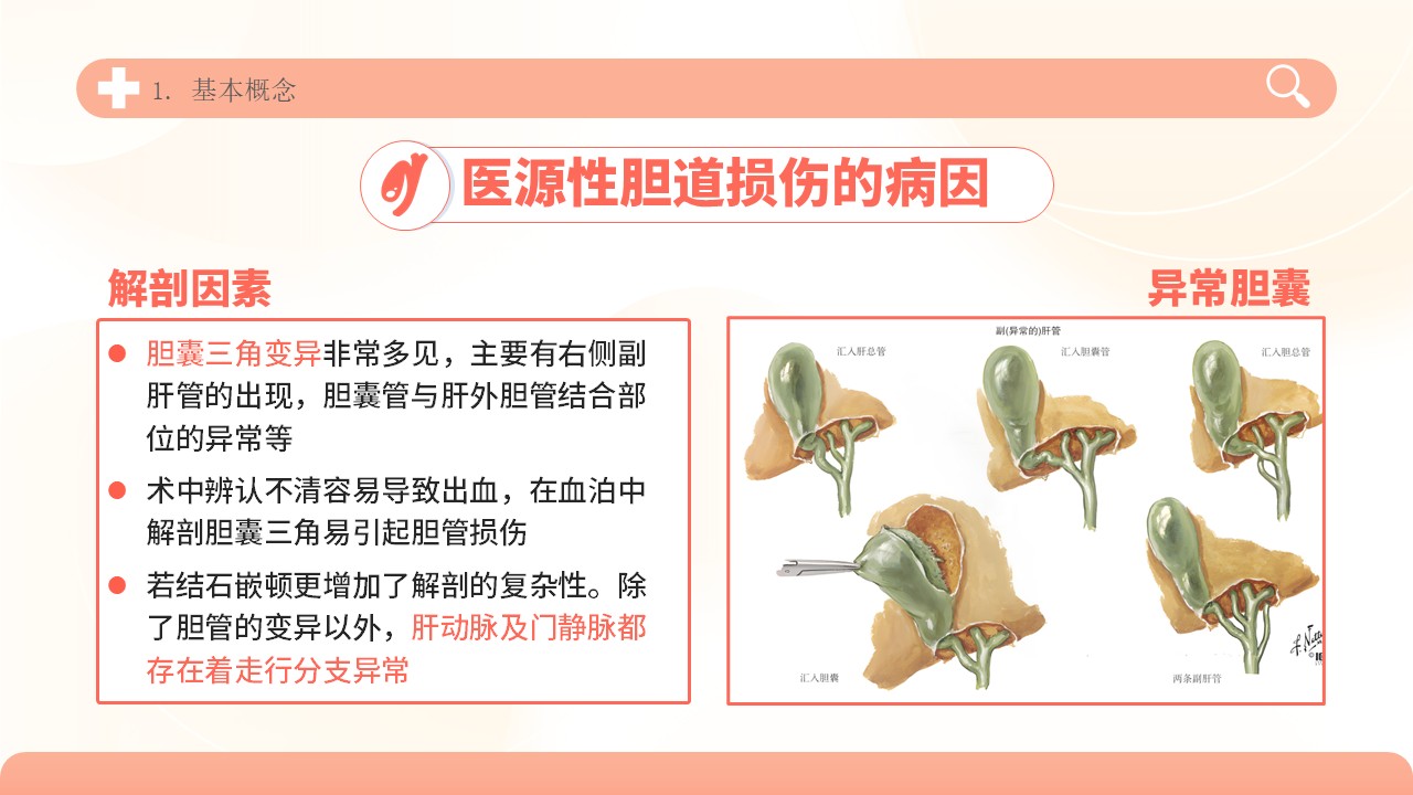 04-胆道损伤护理方案第6页预览