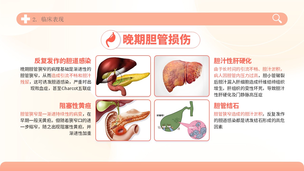 04-胆道损伤护理方案第11页预览
