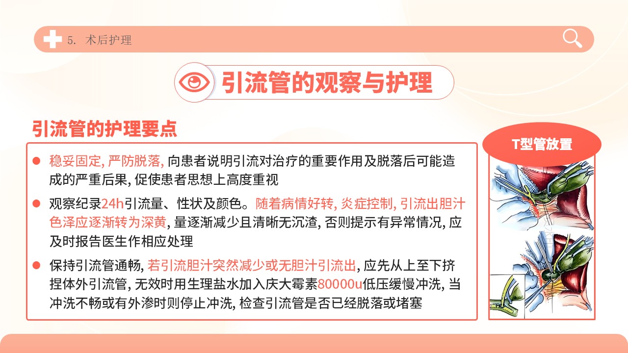04-胆道损伤护理方案第25页预览