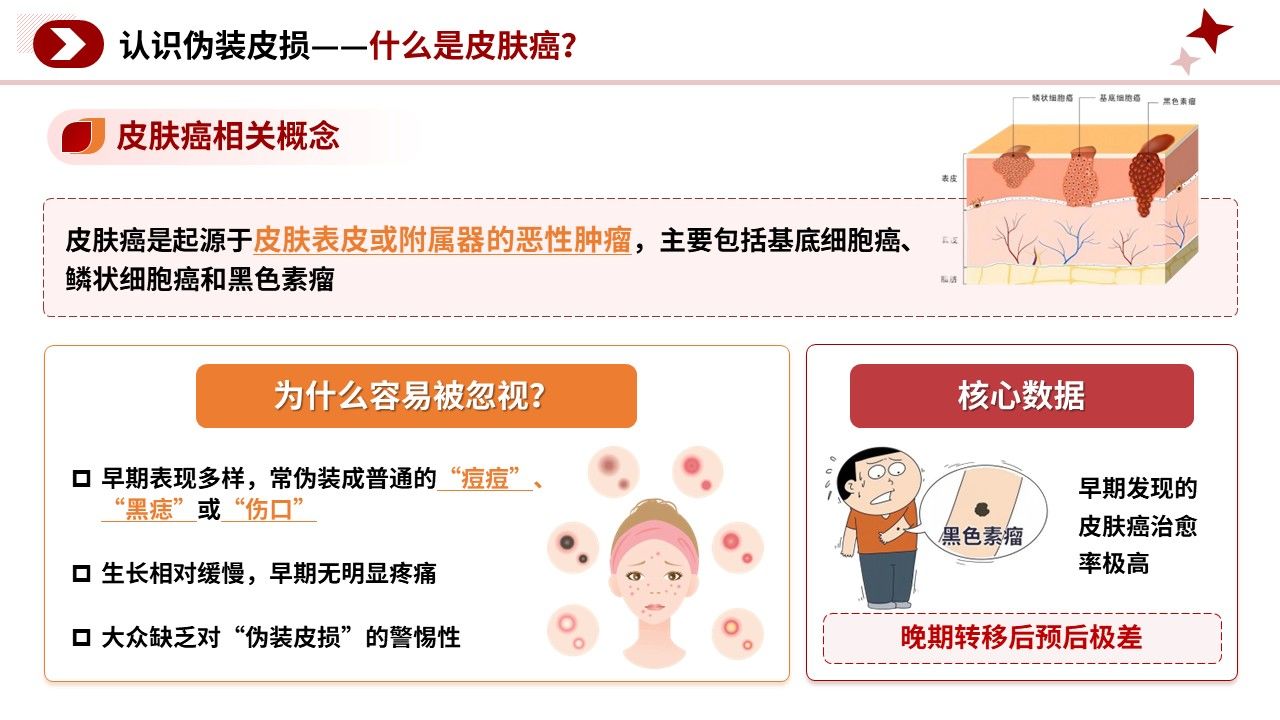 105期-科普宣教-皮肤癌早期识别科普第5页预览
