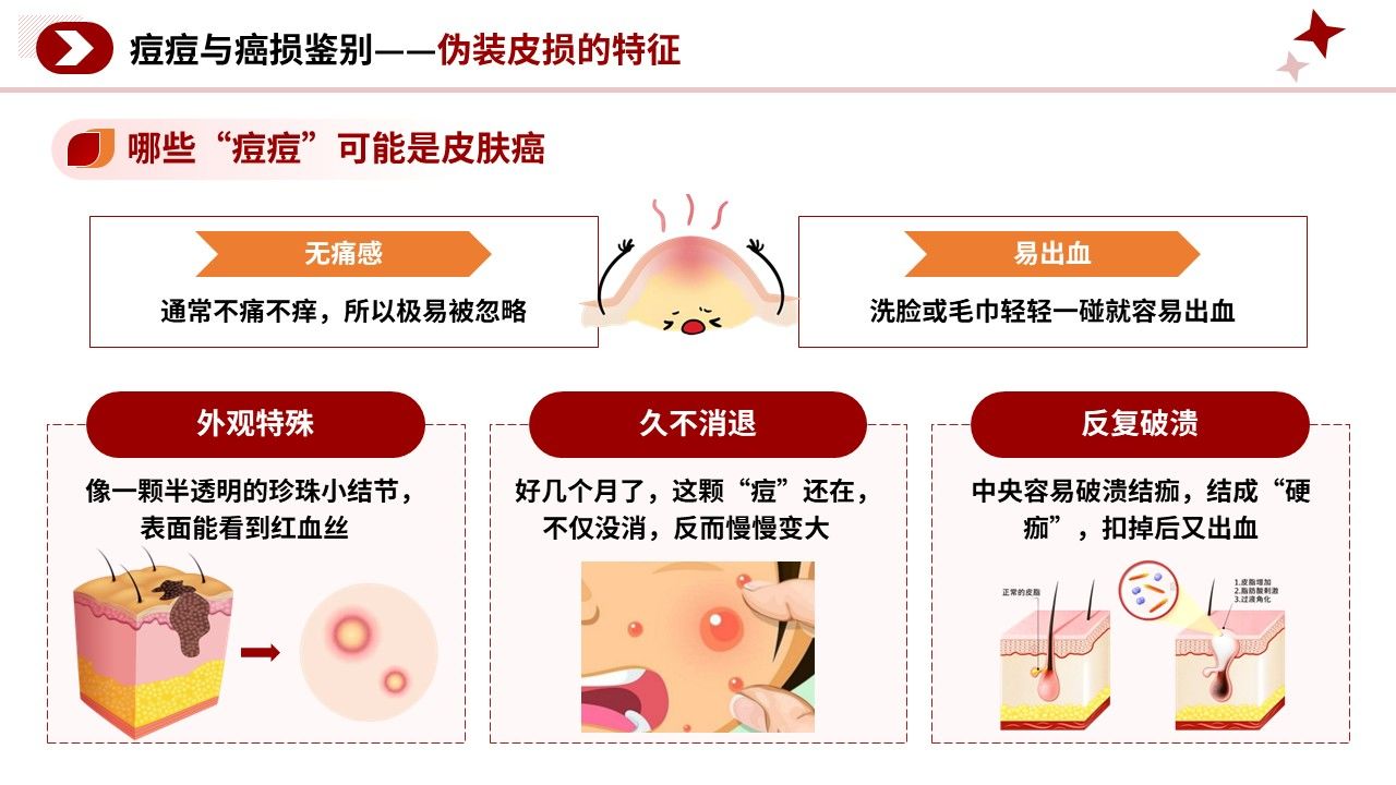 105期-科普宣教-皮肤癌早期识别科普第11页预览