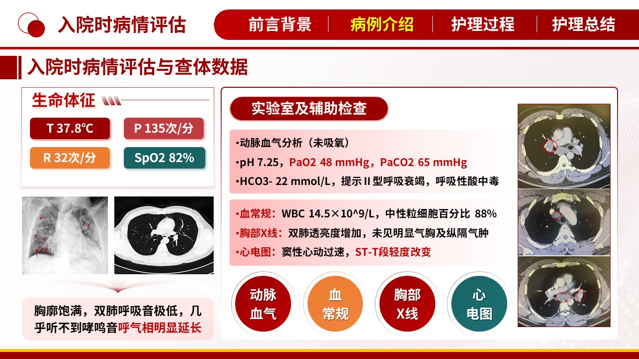 496期-护理个案-一例重症哮喘持续状态患者的护理个案第7页预览