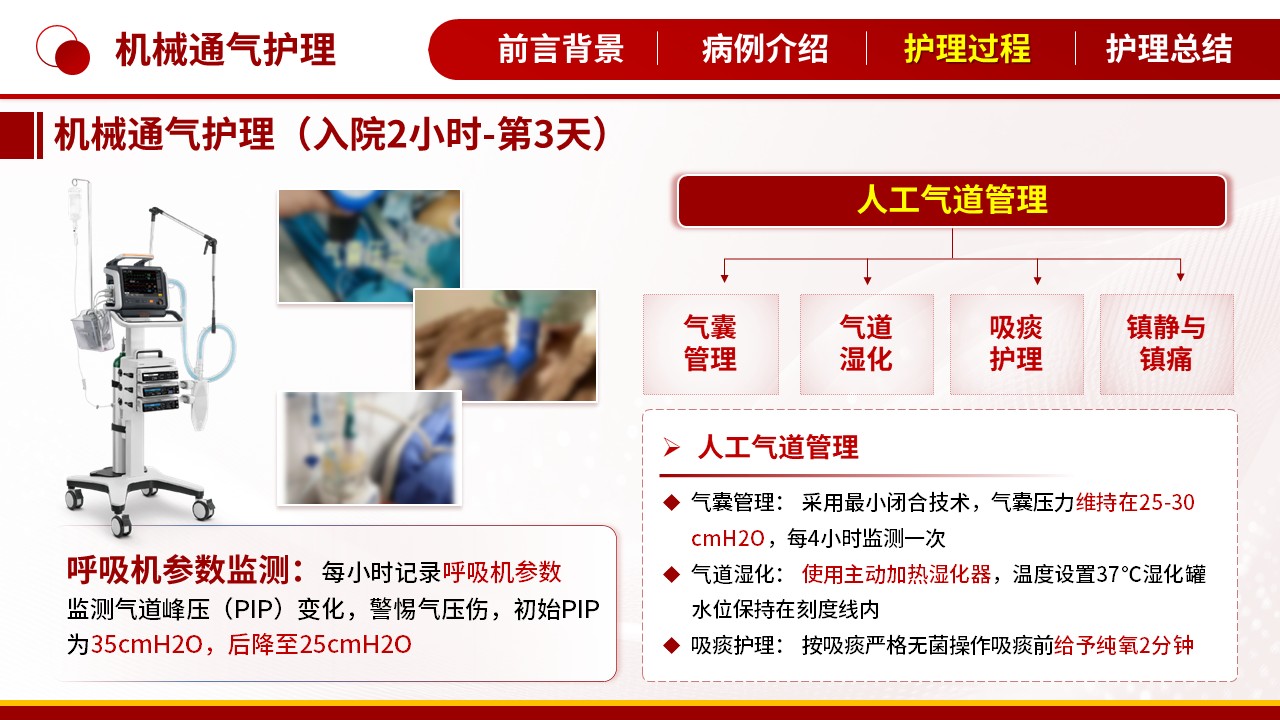 496期-护理个案-一例重症哮喘持续状态患者的护理个案第12页预览