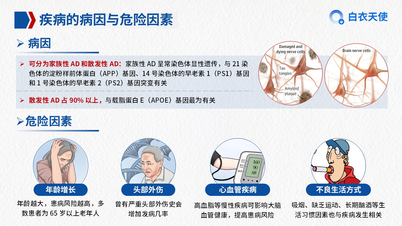 01-阿尔兹海默症健康宣教第5页预览