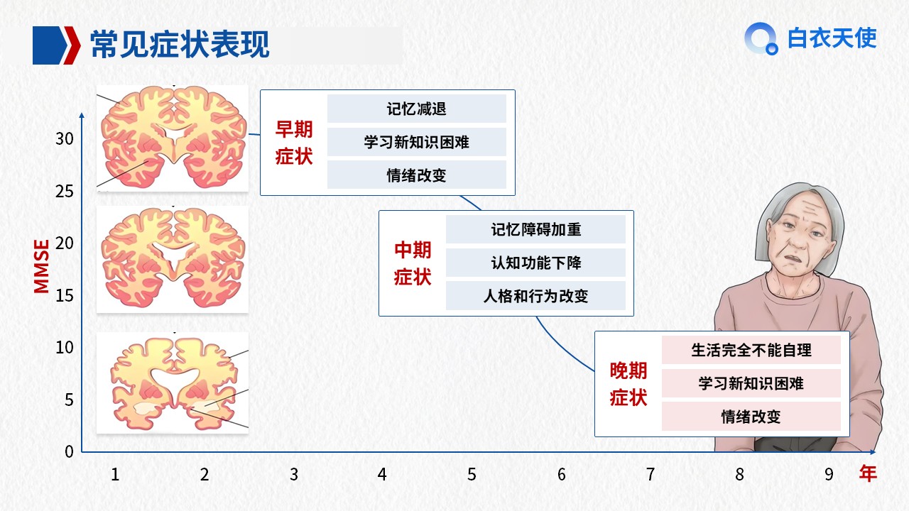 01-阿尔兹海默症健康宣教第6页预览