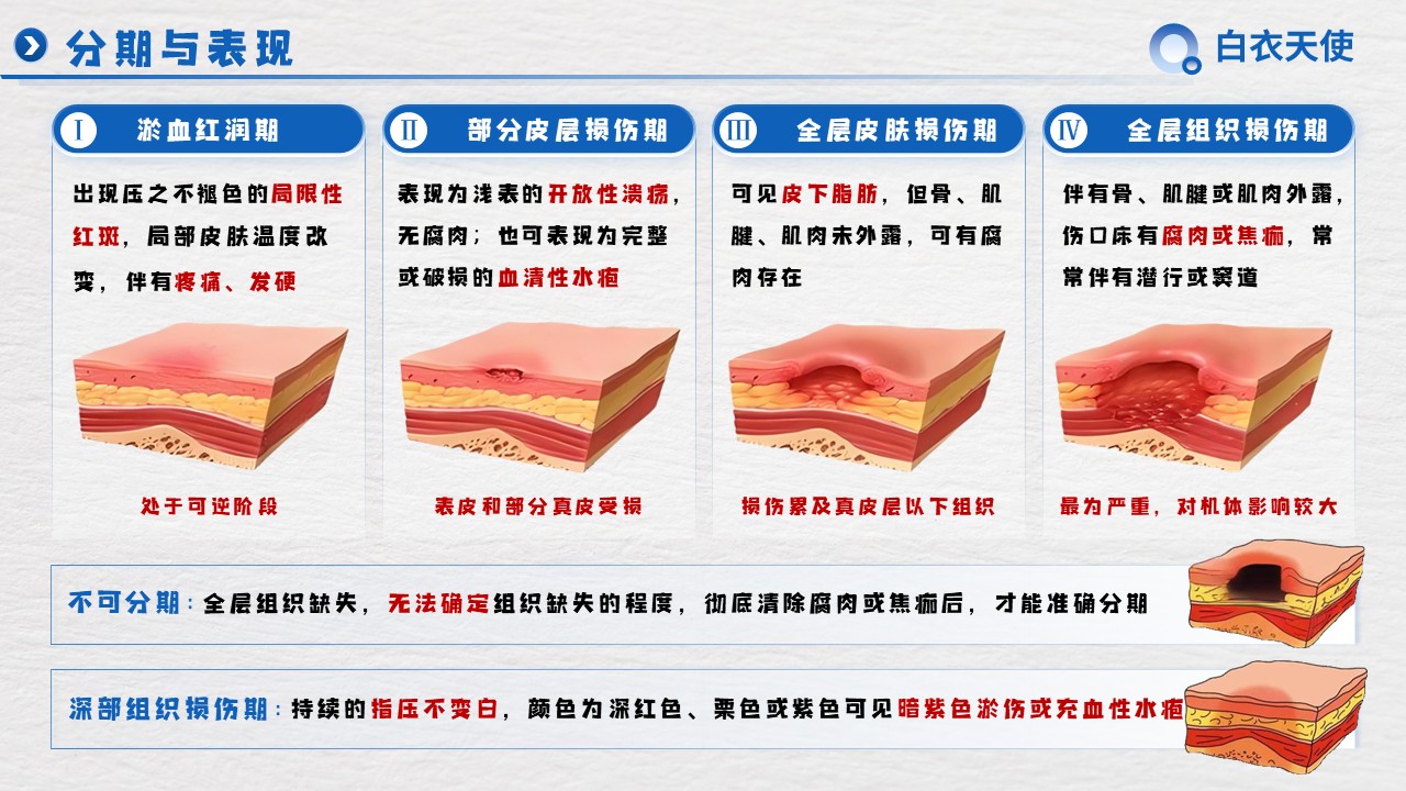 30-压力性损伤健康宣教第4页预览