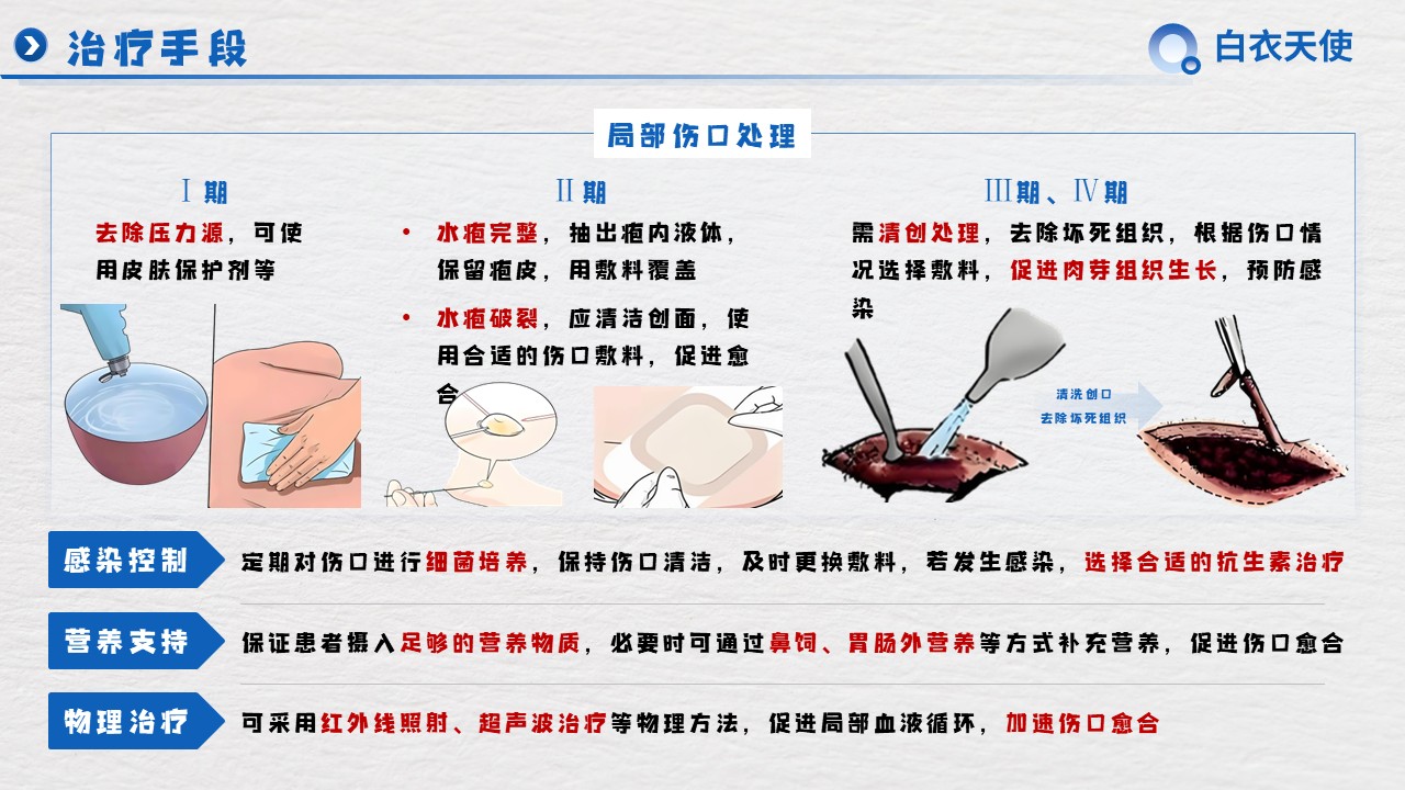 30-压力性损伤健康宣教第9页预览