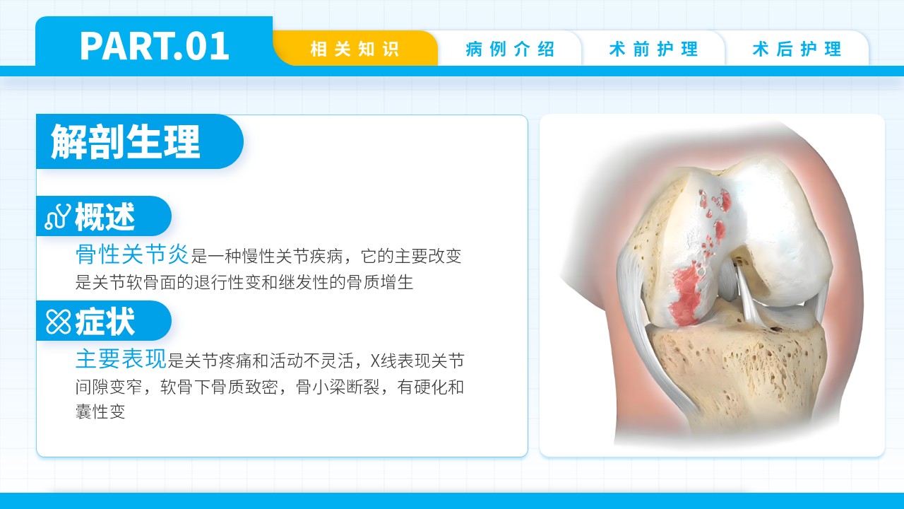 74-双膝骨性关节炎护理查房第4页预览