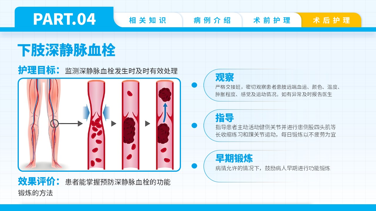 74-双膝骨性关节炎护理查房第16页预览