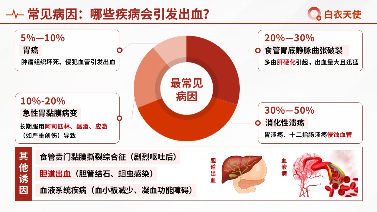 48-上消化道出血健康宣教第4页预览