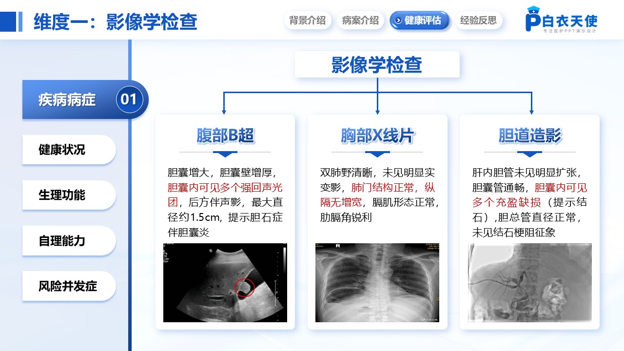 207期-护理个案-一例胆石症伴胆囊炎患者的个案护理第8页预览