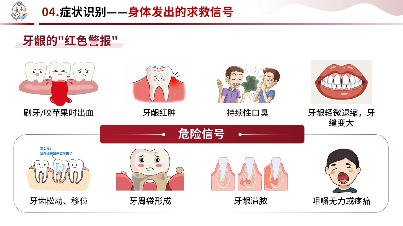 90-牙周炎护理第11页预览