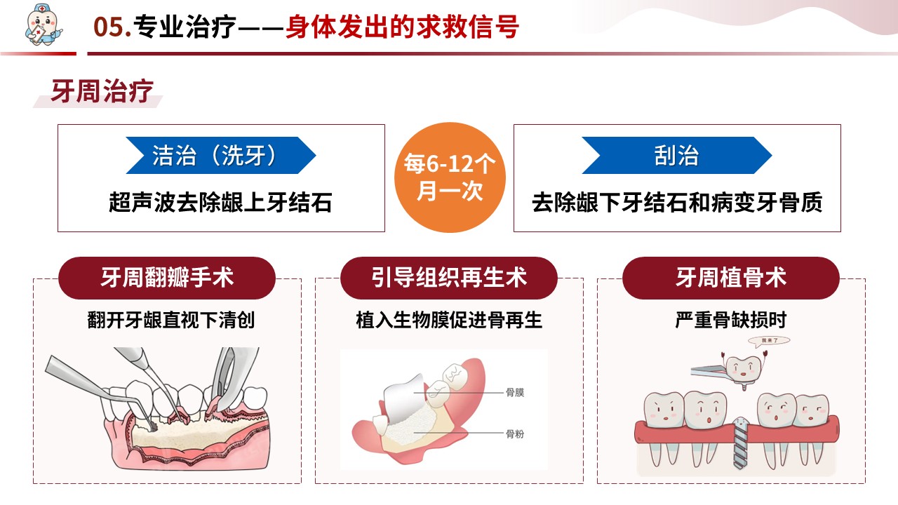 90-牙周炎护理第15页预览