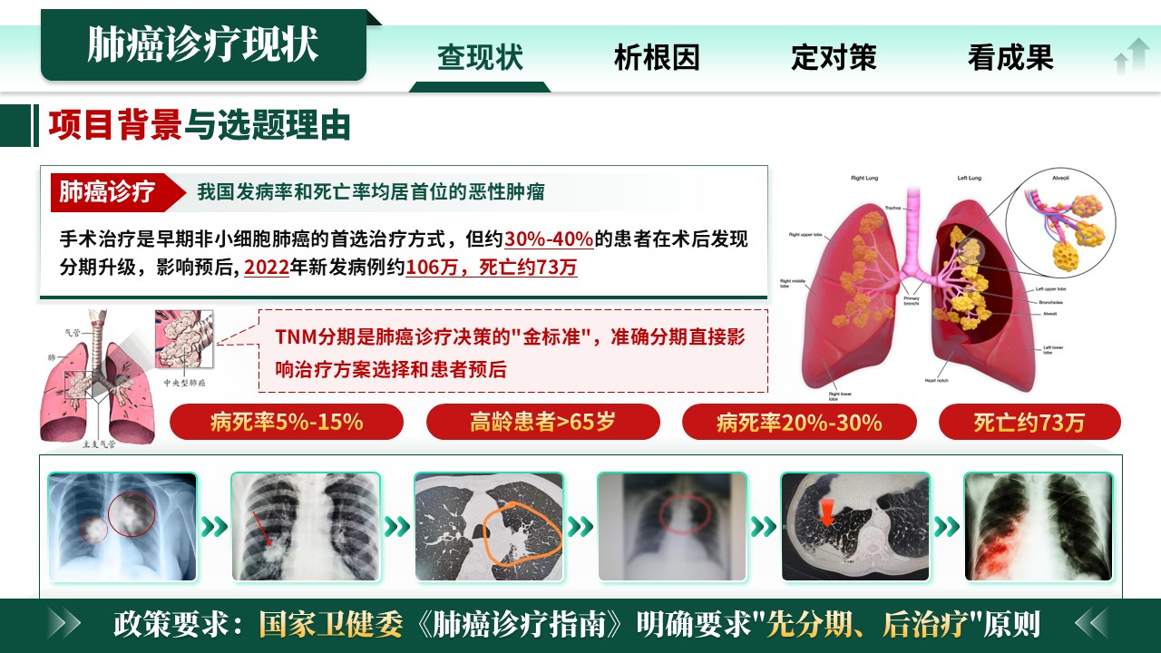 336期-各类质量持续改进-“先分期，后治疗”提高肺癌术前TNM评估率的RPIW改进第3页预览