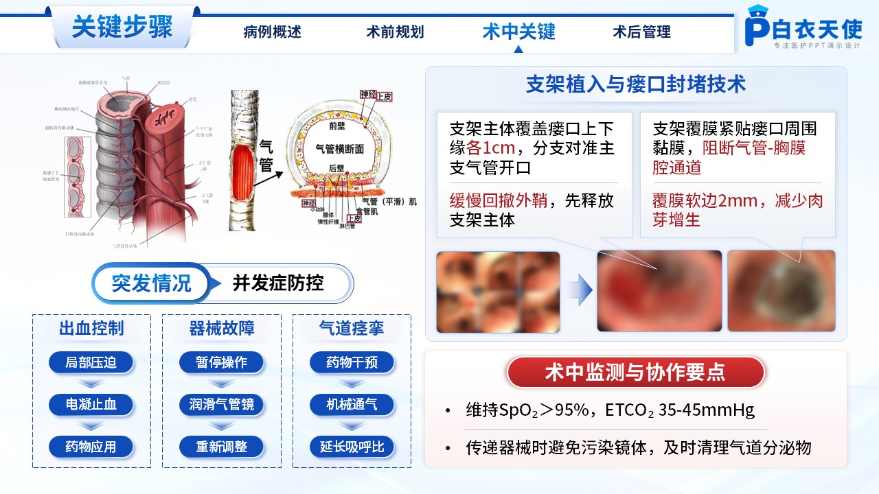 213期-医生个案-一例气管胸膜瘘镜下主气管支架植入术第9页预览