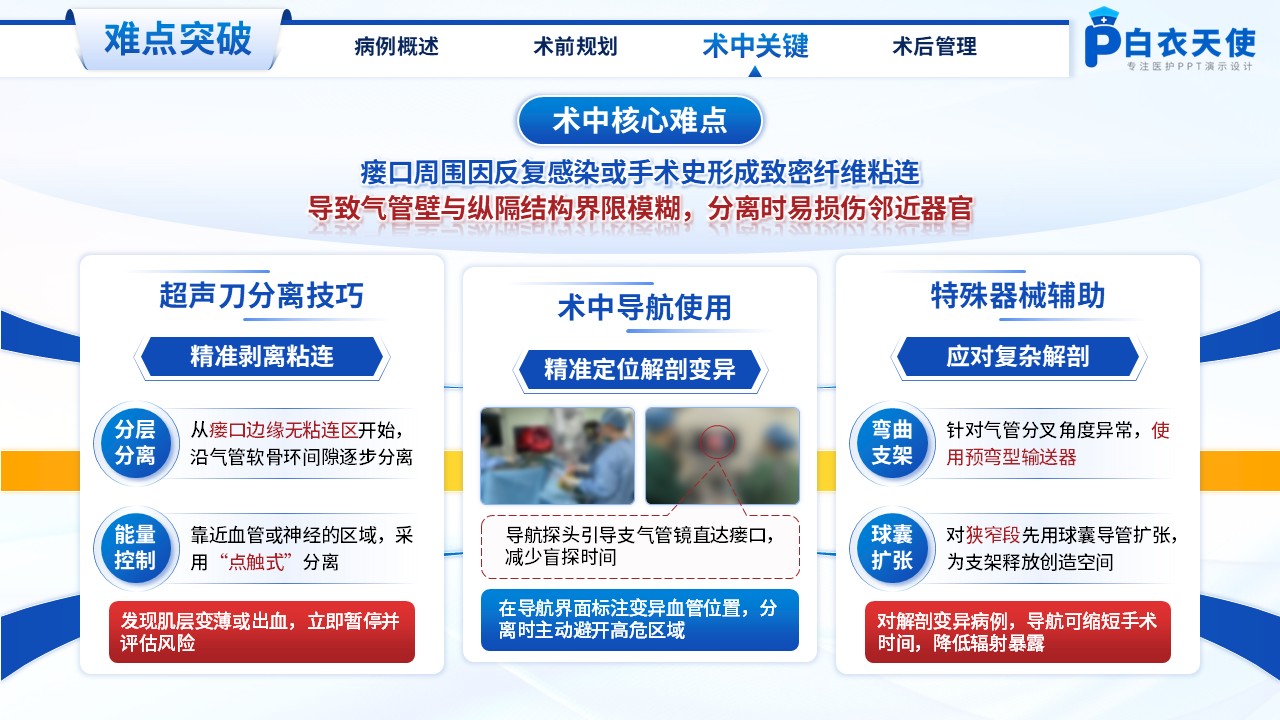 213期-医生个案-一例气管胸膜瘘镜下主气管支架植入术第10页预览