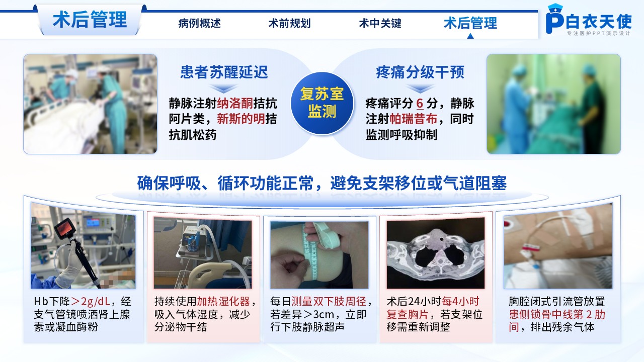 213期-医生个案-一例气管胸膜瘘镜下主气管支架植入术第12页预览