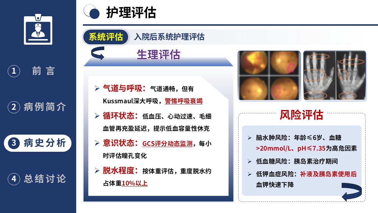 367期-护理个案-一例1型糖尿病儿童酮症酸中毒的病史采集与分析第12页预览