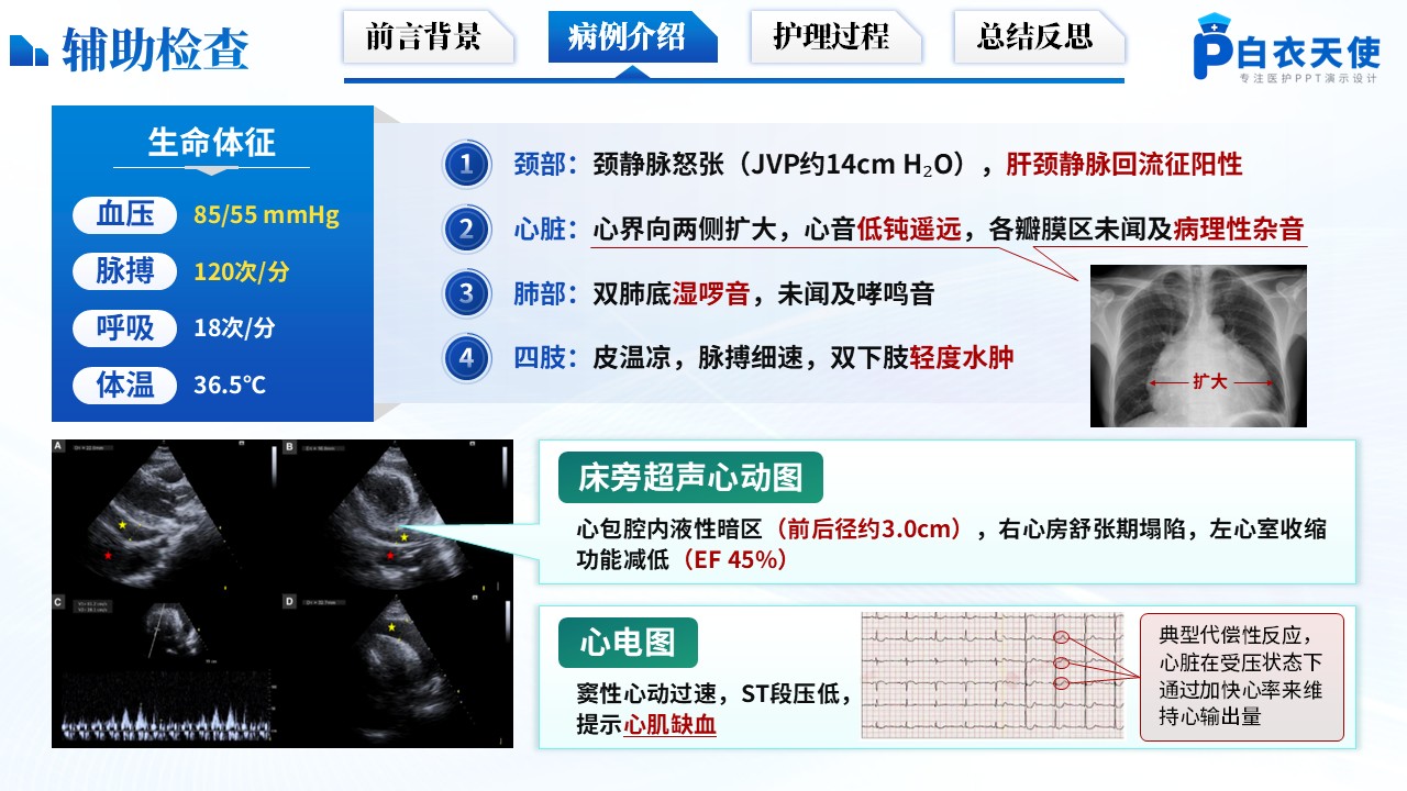175期-护理个案-心肺复苏后并发急性心包填塞第6页预览