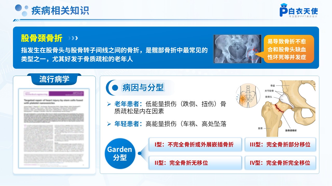 264期-护理查房-卧床患者踝泵运动锻炼的护理查房第3页预览