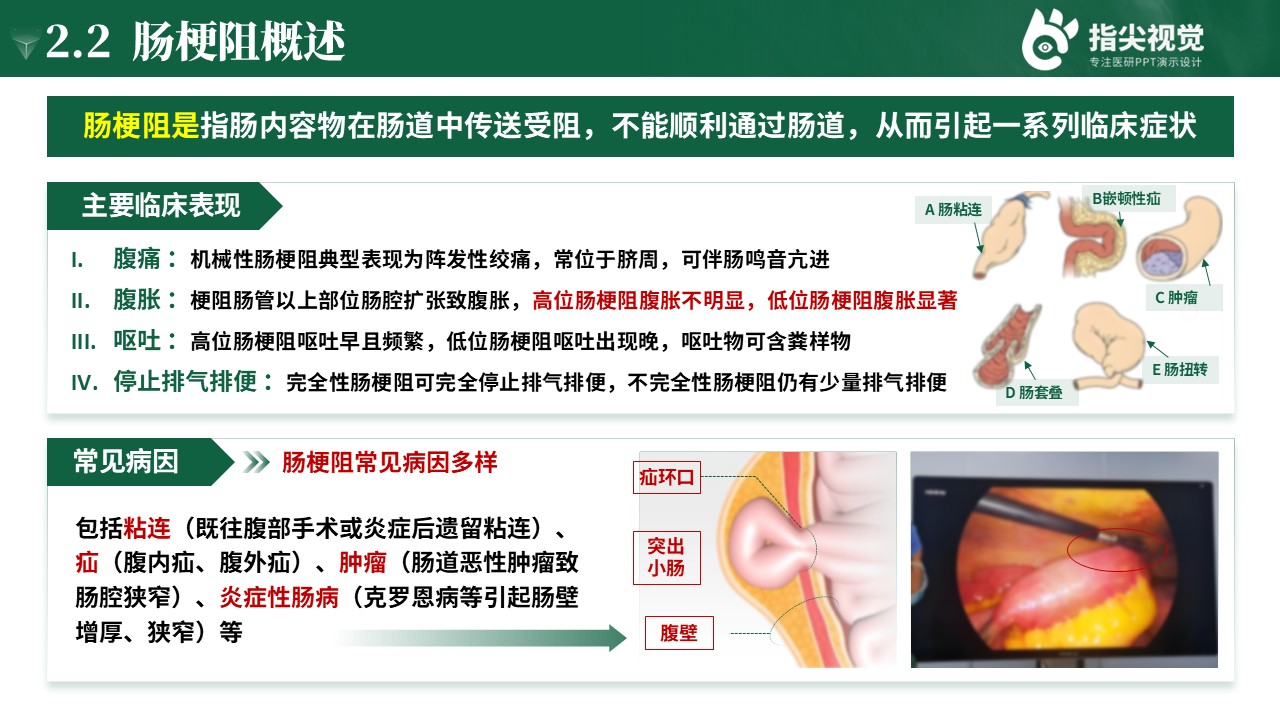 110期-护理个案-肠梗阻个案护理第5页预览