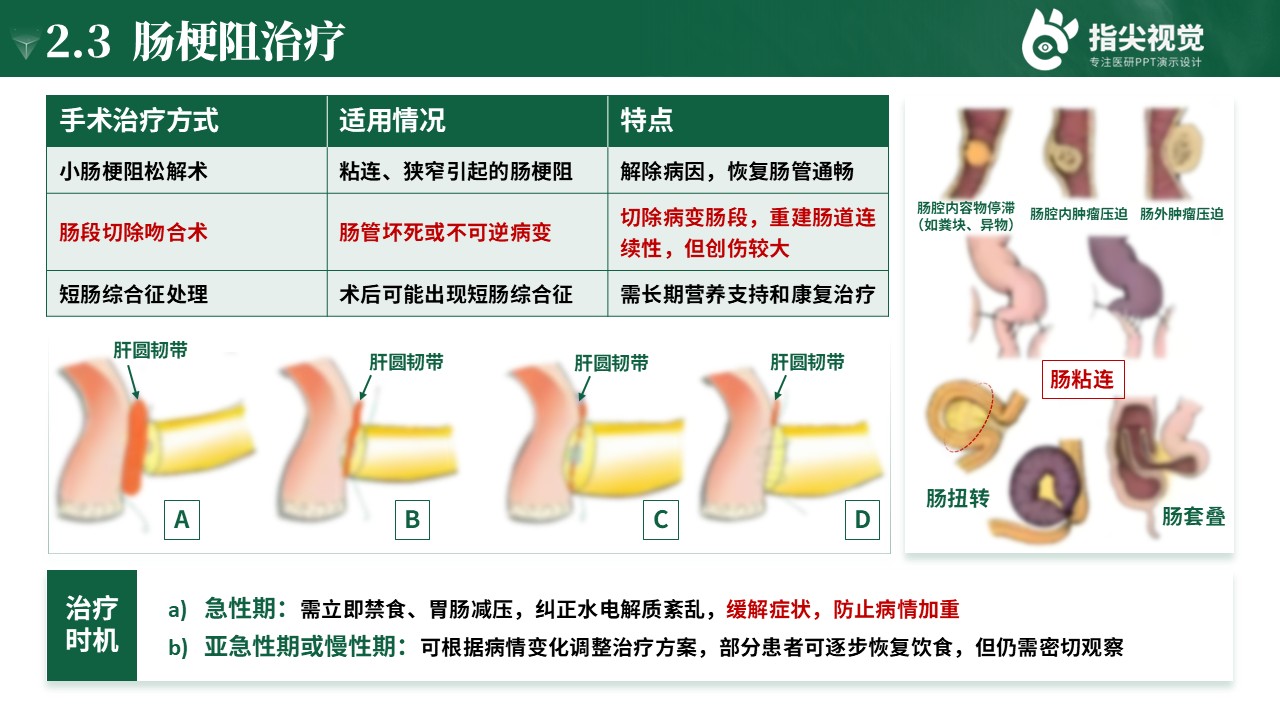 110期-护理个案-肠梗阻个案护理第6页预览