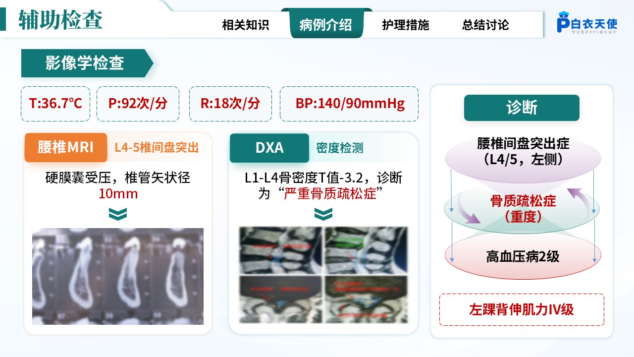 284期-疑难病例-一例腰椎间盘突出合并骨质疏松患者护理第6页预览